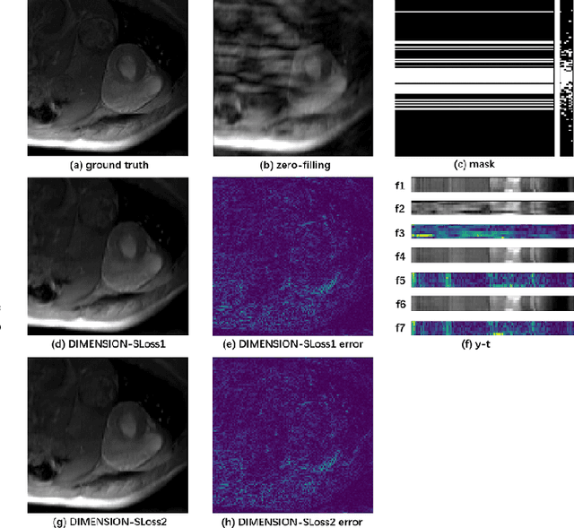 Figure 3 for DIMENSION: Dynamic MR Imaging with Both K-space and Spatial Prior Knowledge Obtained via Multi-Supervised Network Training