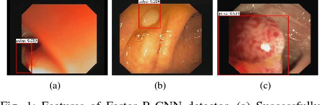 Figure 1 for An Efficient Approach for Polyps Detection in Endoscopic Videos Based on Faster R-CNN