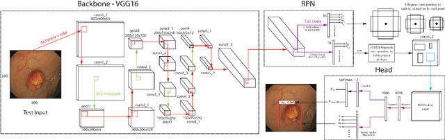 Figure 2 for An Efficient Approach for Polyps Detection in Endoscopic Videos Based on Faster R-CNN