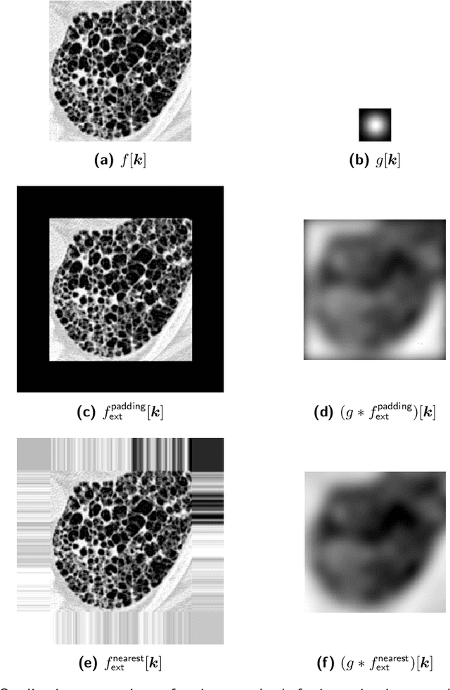 Figure 3 for Standardised convolutional filtering for radiomics