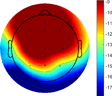 Figure 1 for Inference of the Selective Auditory Attention using Sequential LMMSE Estimation