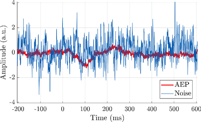 Figure 2 for Inference of the Selective Auditory Attention using Sequential LMMSE Estimation