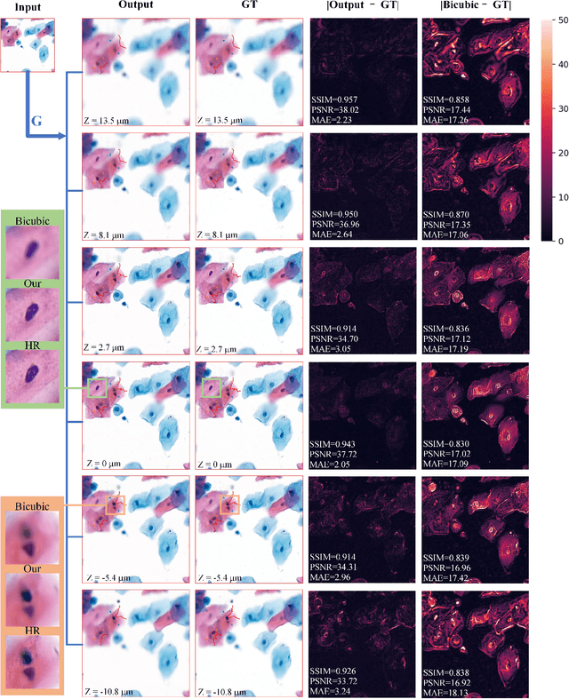 Figure 2 for Reconstruct high-resolution multi-focal plane images from a single 2D wide field image