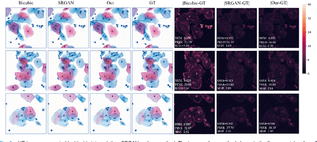 Figure 3 for Reconstruct high-resolution multi-focal plane images from a single 2D wide field image
