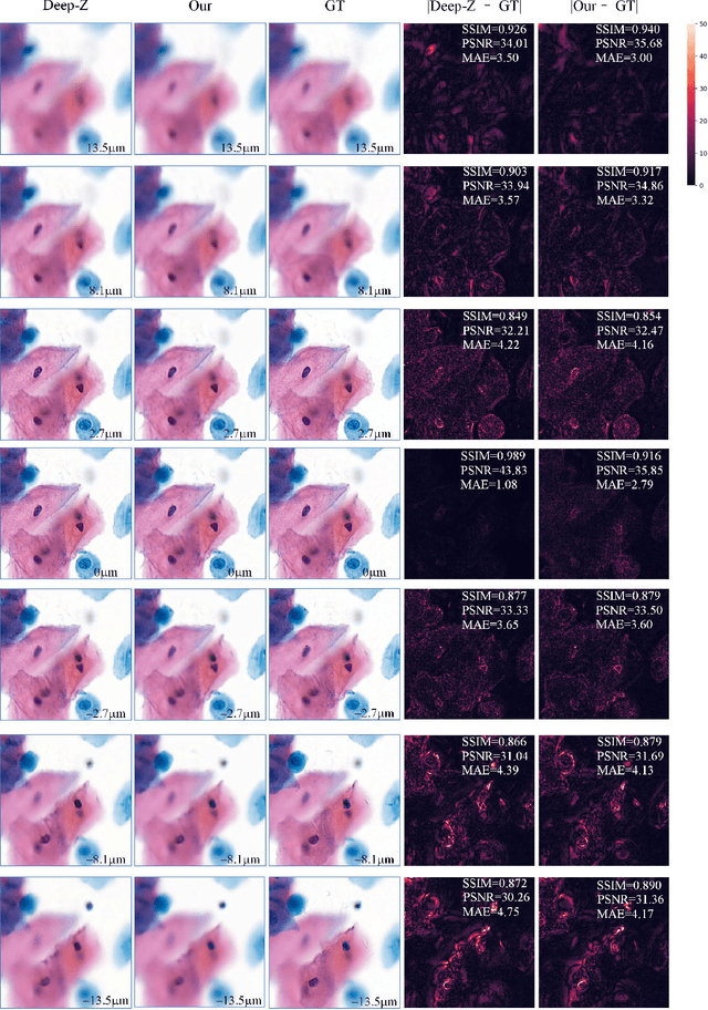 Figure 4 for Reconstruct high-resolution multi-focal plane images from a single 2D wide field image