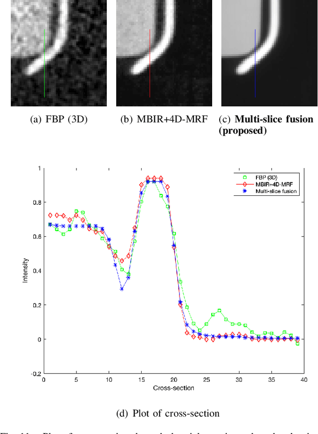 Figure 3 for Multi-Slice Fusion for Sparse-View and Limited-Angle 4D CT Reconstruction