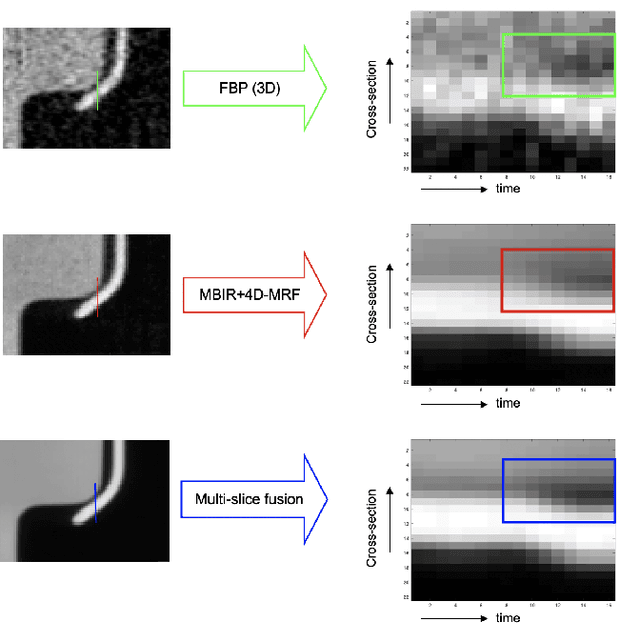 Figure 4 for Multi-Slice Fusion for Sparse-View and Limited-Angle 4D CT Reconstruction