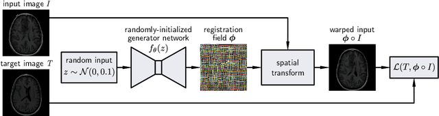 Figure 1 for Deformable Medical Image Registration Using a Randomly-Initialized CNN as Regularization Prior