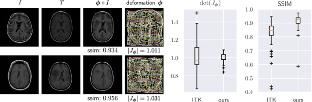 Figure 2 for Deformable Medical Image Registration Using a Randomly-Initialized CNN as Regularization Prior