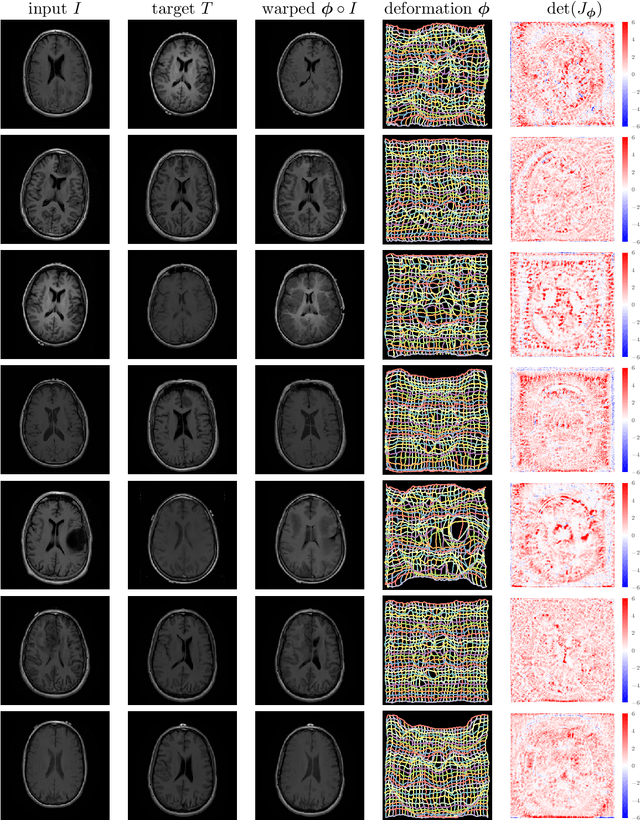 Figure 3 for Deformable Medical Image Registration Using a Randomly-Initialized CNN as Regularization Prior