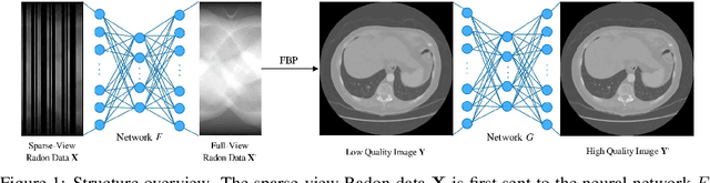 Figure 1 for A Lightweight Structure Aimed to Utilize Spatial Correlation for Sparse-View CT Reconstruction