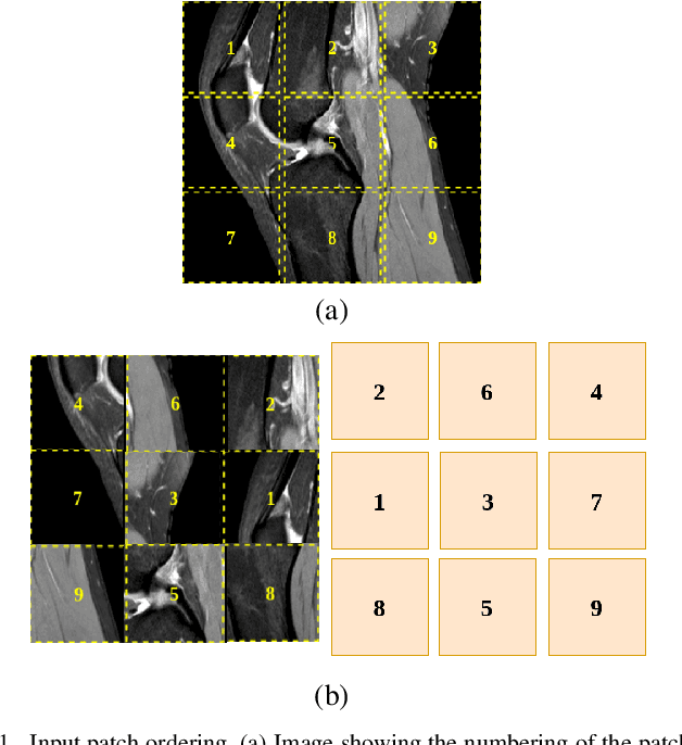 Figure 1 for Self-Supervised Representation Learning for Detection of ACL Tear Injury in Knee MRI