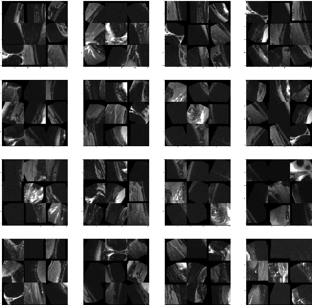 Figure 2 for Self-Supervised Representation Learning for Detection of ACL Tear Injury in Knee MRI