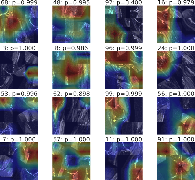 Figure 3 for Self-Supervised Representation Learning for Detection of ACL Tear Injury in Knee MRI