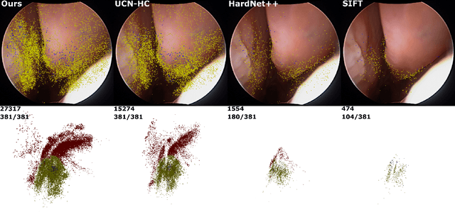 Figure 1 for Extremely Dense Point Correspondences using a Learned Feature Descriptor