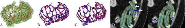 Figure 4 for Graph-Based Small Bowel Path Tracking with Cylindrical Constraints