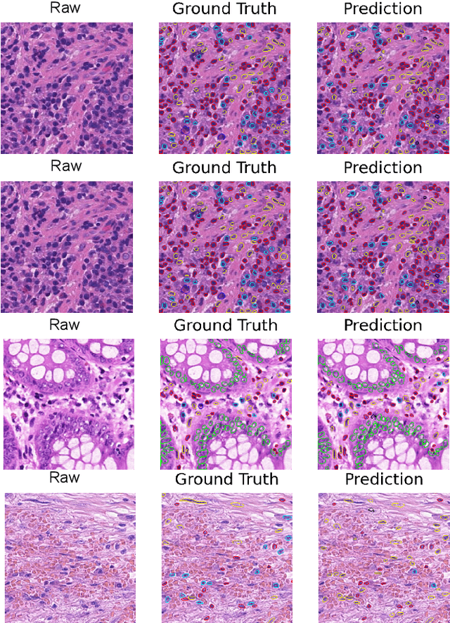 Figure 3 for MF-Hovernet: An Extension of Hovernet for Colon Nuclei Identification and Counting (CoNiC) Challenge