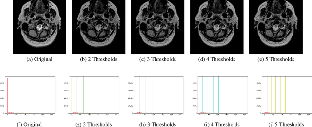 Figure 4 for Segmentation of Brain MRI using an Altruistic Harris Hawks' Optimization algorithm