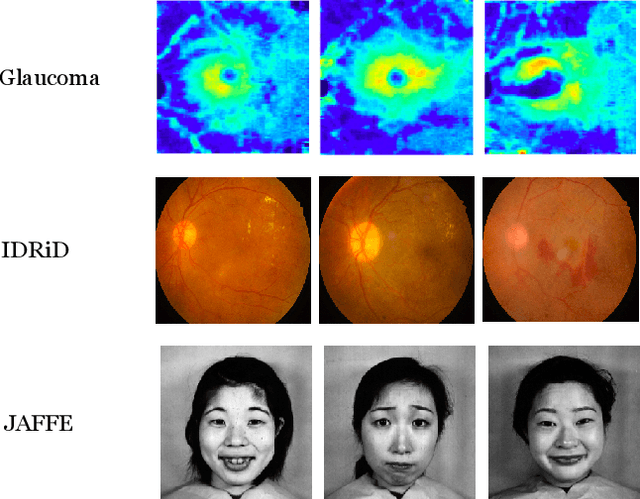 Figure 1 for A Novel Global Spatial Attention Mechanism in Convolutional Neural Network for Medical Image Classification