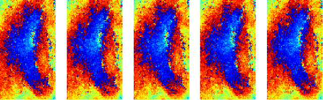 Figure 3 for A Novel Generative Neural Approach for InSAR Joint Phase Filtering and Coherence Estimation
