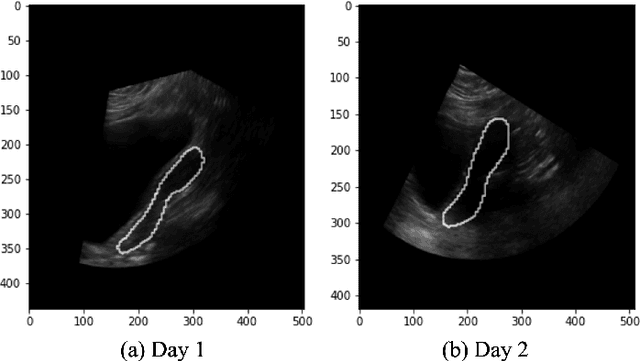 Figure 1 for Automatic 3D Ultrasound Segmentation of Uterus Using Deep Learning
