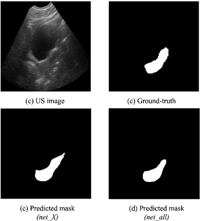Figure 4 for Automatic 3D Ultrasound Segmentation of Uterus Using Deep Learning