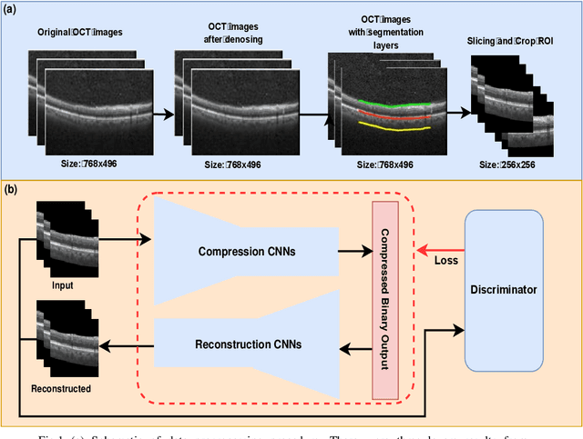 Figure 1 for Customized OCT images compression scheme with deep neural network