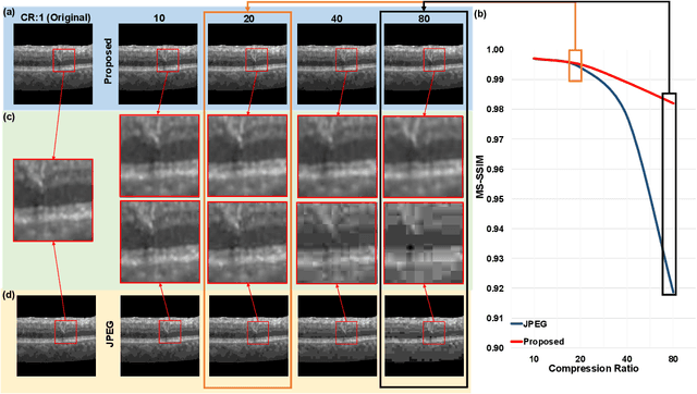 Figure 3 for Customized OCT images compression scheme with deep neural network