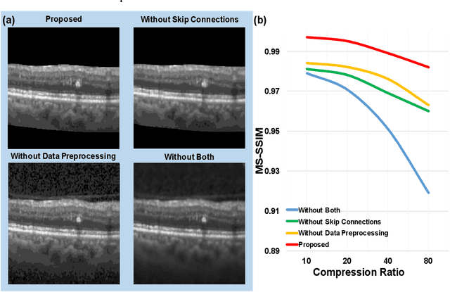 Figure 4 for Customized OCT images compression scheme with deep neural network