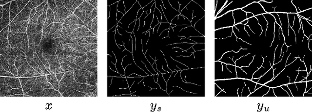 Figure 3 for OCTAve: 2D en face Optical Coherence Tomography Angiography Vessel Segmentation in Weakly-Supervised Learning with Locality Augmentation