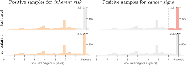 Figure 4 for Decoupling Inherent Risk and Early Cancer Signs in Image-based Breast Cancer Risk Models