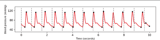 Figure 3 for Continuous Monitoring of Blood Pressure with Evidential Regression