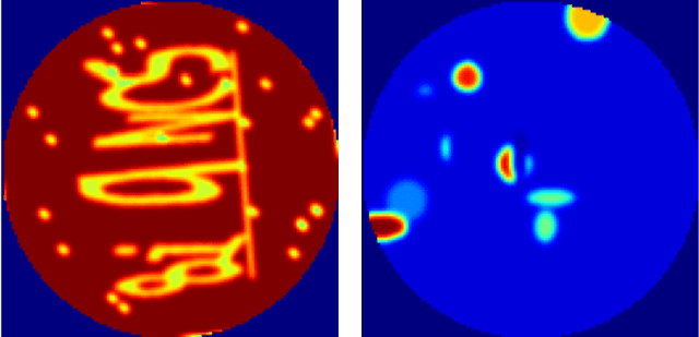 Figure 1 for SPECT Angle Interpolation Based on Deep Learning Methodologies