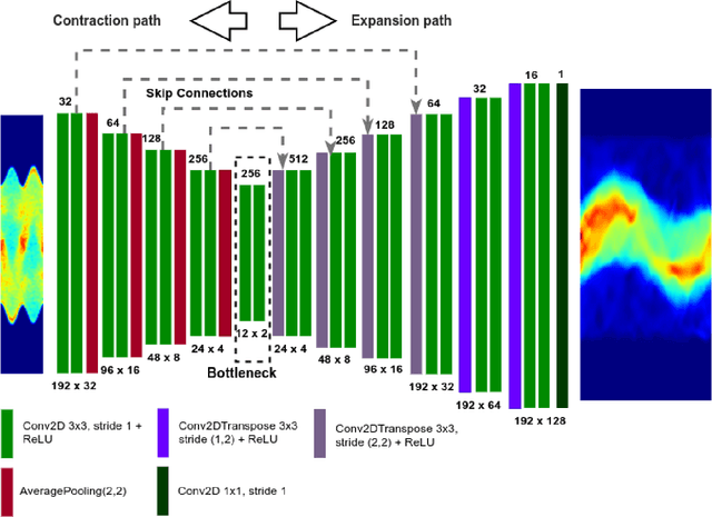 Figure 2 for SPECT Angle Interpolation Based on Deep Learning Methodologies