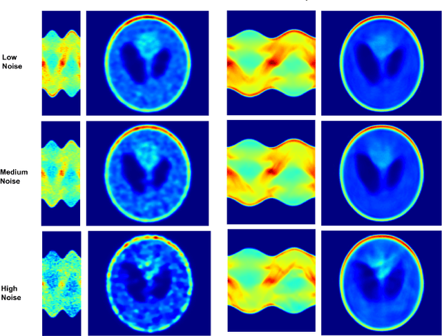 Figure 4 for SPECT Angle Interpolation Based on Deep Learning Methodologies