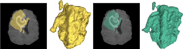 Figure 1 for OSS-Net: Memory Efficient High Resolution Semantic Segmentation of 3D Medical Data