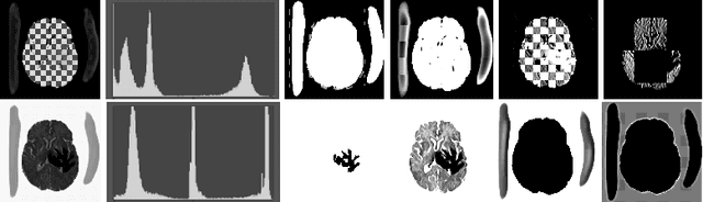 Figure 3 for ASC-Net: Unsupervised Medical Anomaly Segmentation Using an Adversarial-based Selective Cutting Network