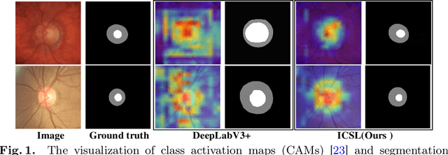 Figure 1 for Invariant Content Synergistic Learning for Domain Generalization of Medical Image Segmentation