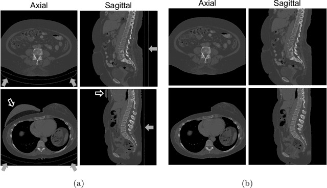 Figure 1 for 3D deformable registration of longitudinal abdominopelvic CT images using unsupervised deep learning