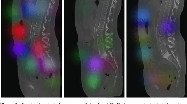 Figure 3 for 3D deformable registration of longitudinal abdominopelvic CT images using unsupervised deep learning