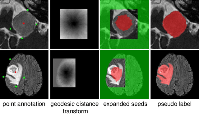 Figure 1 for PA-Seg: Learning from Point Annotations for 3D Medical Image Segmentation using Contextual Regularization and Cross Knowledge Distillation