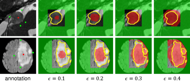 Figure 3 for PA-Seg: Learning from Point Annotations for 3D Medical Image Segmentation using Contextual Regularization and Cross Knowledge Distillation