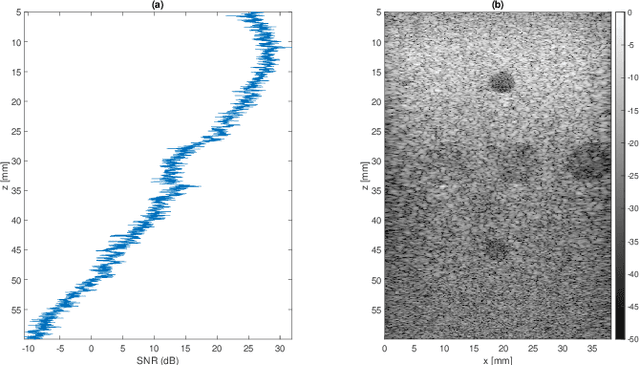 Figure 1 for Deep Ultrasound Denoising Without Clean Data