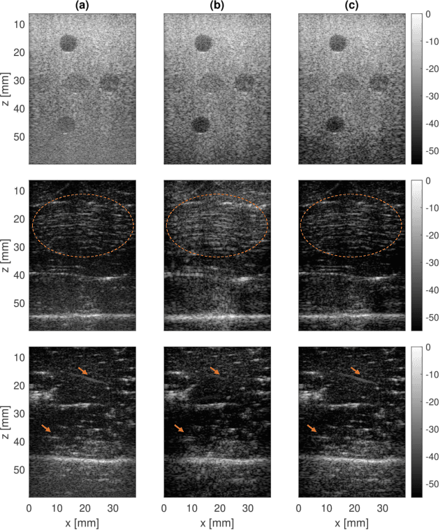 Figure 4 for Deep Ultrasound Denoising Without Clean Data