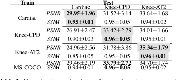 Figure 1 for Generalising Deep Learning MRI Reconstruction across Different Domains