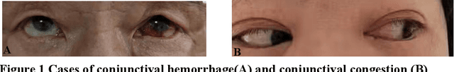 Figure 2 for Rapid COVID-19 Risk Screening by Eye-region Manifestations