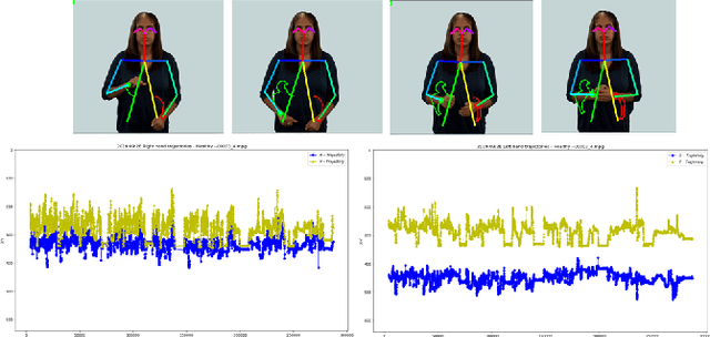 Figure 3 for A Multi-modal Machine Learning Approach and Toolkit to Automate Recognition of Early Stages of Dementia among British Sign Language Users
