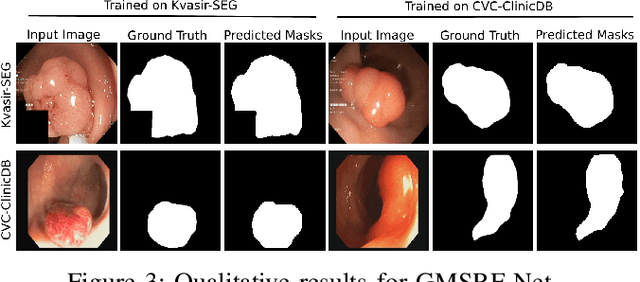 Figure 3 for GMSRF-Net: An improved generalizability with global multi-scale residual fusion network for polyp segmentation