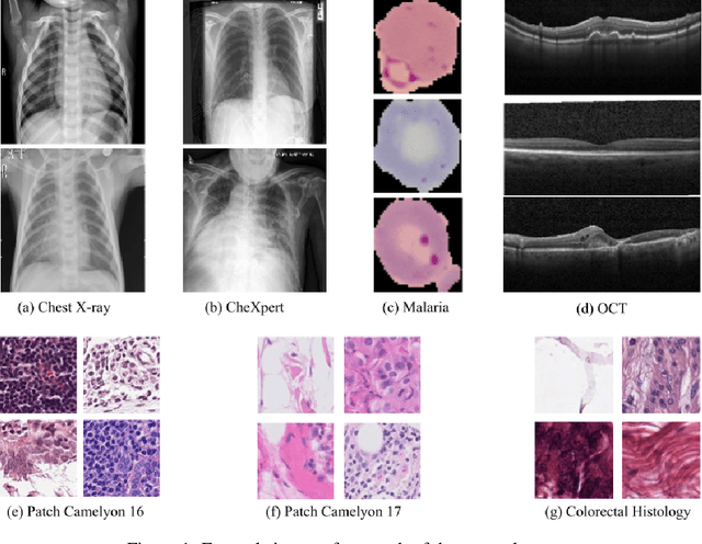 Figure 1 for Partial transfusion: on the expressive influence of trainable batch norm parameters for transfer learning
