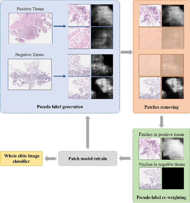 Figure 2 for Mixed Supervision Learning for Whole Slide Image Classification
